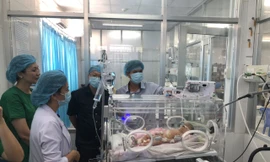 Cứu sống bé gái 9 ngày tuổi có tạng từ ổ bụng chui lên lồng ngực