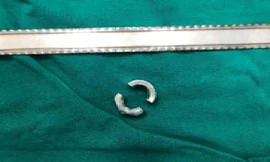 Bé trai suýt phải cắt bỏ dương vật vì ‘lỡ dại’