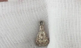 Lấy thành công mặt dây chuyền nằm trong 'vùng kín' bé gái 5 tuổi