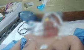 Anh Tấn tử vong do chấn thương sọ não.