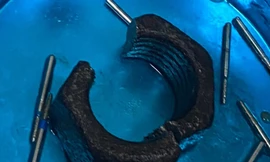 Chơi dại, nam thanh niên tự nhét ‘của quý’ vào đai ốc lục giác