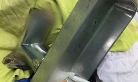 Rút nhầm phích cắm điện, người phụ nữ bị máy xay thịt cuốn nát bàn tay