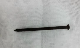 Suýt chết vì tự nuốt đinh sắt dài 8cm vào bụng