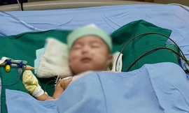 Vá lỗ thông liên thất cực lớn, cứu sống bé trai 5 tháng tuổi