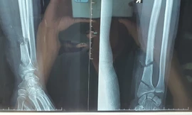 Dùng máy cưa tỉa cây, người đàn ông bị cắt đứt gần lìa cổ tay và cổ chân