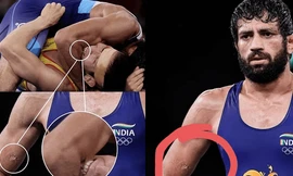 Vết cắn của Nurislam Sanayev hằn sâu trên cánh tay của Ravi Dahiya
