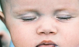 Chụp cắt lớp cho biết sự phát triển não bộ ở trẻ sơ sinh