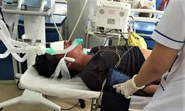 Người đàn ông bị rắn hổ chúa cắn diễn tiến nặng