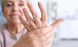 Viên khớp vảy nến nếu không điều trị kịp thời dễ dẫn đến nguy cơ tử vong