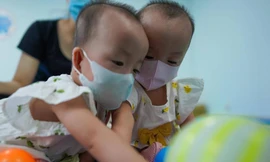 Trúc Nhi - Diệu Nhi chuẩn bị xuất viện sau 2 tháng tách dính