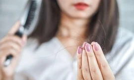 Tóc rụng từng mảng khiến chị em lo lắng