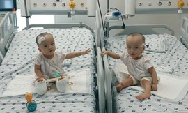 Lần đầu tiên sau tách rời, Trúc Nhi - Diệu Nhi được chạm tay nhau (Ảnh:BVCC)