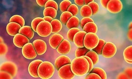 Phát hiện chùm ca mắc bệnh tình dục do nhiễm khuẩn não mô cầu hiếm gặp tại Việt Nam