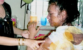 Chồng tạt nước sôi lên vợ vì bị đòi ly dị