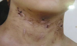 Khởi tố kẻ đánh con gái 6 tuổi, bỏ lại nghĩa trang