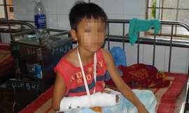 Điều tra vụ bé trai lớp 5 bị chém