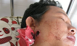 Phó công an xã bắn người bị còng tay