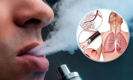 Bộ Công Thương kiến nghị chưa cho lưu hành thuốc lá điện tử 