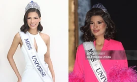 Miss Universe 2023 Sheynnis Palacios "bị hại" trong loạt ảnh chưa qua chỉnh sửa 