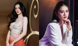 Hoa hậu Ý Nhi xinh đẹp hơn sau phẫu thuật thẩm mỹ nhưng netizen lo ngại một điểm