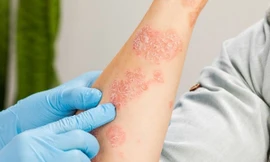 Ảnh minh hoạ: Internet