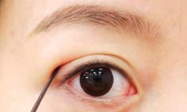 Rợn người kiểu làm đẹp ‘hành xác’ của giới trẻ