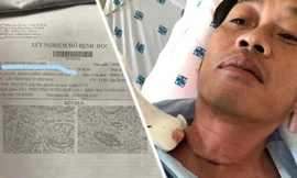 Hoài Linh hai lần xạ trị, phải uống hormon hằng ngày