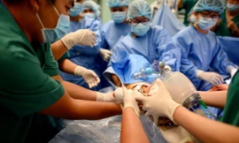 Đã tách thành công hai bé Trúc Nhi - Diệu Nhi dính nhau 