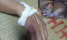 Do chủ quan không đi khám, điều trị sau khi bị chuột cắn, bệnh nhân L.H.L bị sốt cao, hạch nổi, phải điều trị, cấp cứu tích cực .Ảnh: TL 