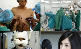 'Giá đắt' cho việc chuyển giới nam thành nữ