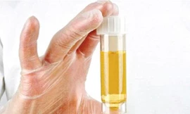 Ảnh minh hoạ: Internet