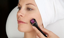 Lăn kim làm đẹp là phương pháp nguy hiểm, có thể nhiễm nhiều căn bệnh chết người. Ảnh minh hoạ: Internet