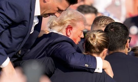 Ông Trump bị bắn vào tai phải trong cuộc vận động ngày 13/7. (Ảnh: Reuters)