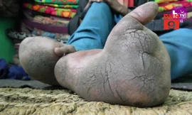 Cô gái xinh đẹp có bàn chân khổng lồ như chân voi