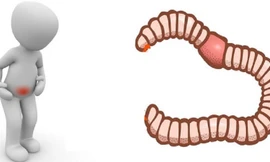 10 dấu hiệu nhận biết người bị nhiễm sán dây