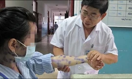 Cách phòng tránh những mối nguy hại từ thời tiết nồm ẩm