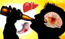 Rượu bia gây 7 loại ung thư và 200 bệnh