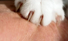 Lây dại từ vết mèo cào, bé trai 11 tuổi ở Tuyên Quang thiệt mạng