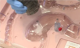 Viên thuốc 'bong bóng' giúp kiểm soát cân nặng