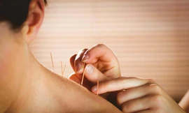 Giảm cân hiệu quả bằng phương pháp châm cứu