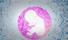 Quá trình thụ tinh trong ống nghiệm diễn ra thế nào