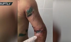 Bác tra tấn cháu ruột như thời Trung cổ gây chấn động dư luận