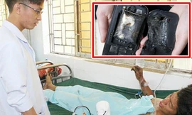 Điện thoại nổ khi đang sạc, thanh niên 22 tuổi ở Đồng Nai mất bàn tay