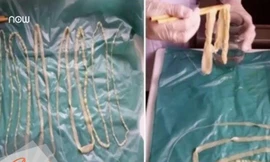 Nguyên tắc sống còn trong ăn uống để không mắc sán lợn