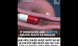 Độc đáo công nghệ tiêm không đau bằng cách đâm kim thẳng vào… thành ruột