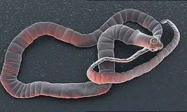 Ít nhất 55 tỉnh, thành có người bị mắc bệnh sán dây, ấu trùng sán lợn