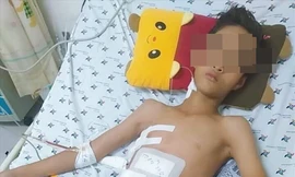 Cứu sống bé trai bị thanh sắt đâm xuyên ngực