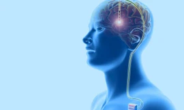 Phẫu thuật não để cai nghiện ma túy đá được thực hiện như thế nào?