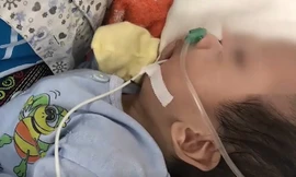 Căn bệnh nguy hiểm khiến trẻ có khuôn mặt hình mỏ chim