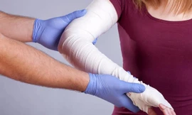 Làm gì khi sơ cứu nạn nhân bị bỏng axit?